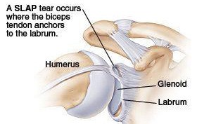 slap tear